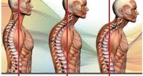 Neck & Shoulder Tension?